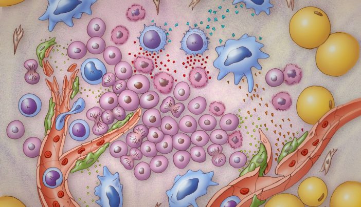 tumor microenvironment